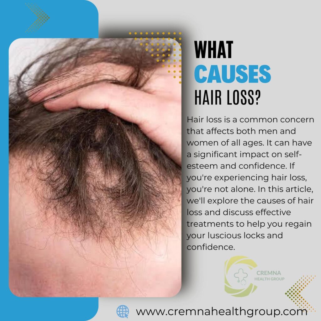 Picture that telling causes hair loss